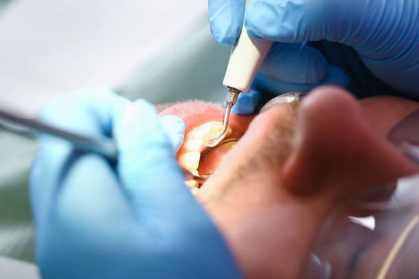 Best Broken or Chipped Tooth Repair in Bagley, MN