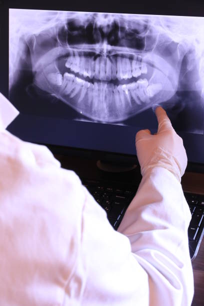 Best Dental Abscess Treatment in Bagley, MN